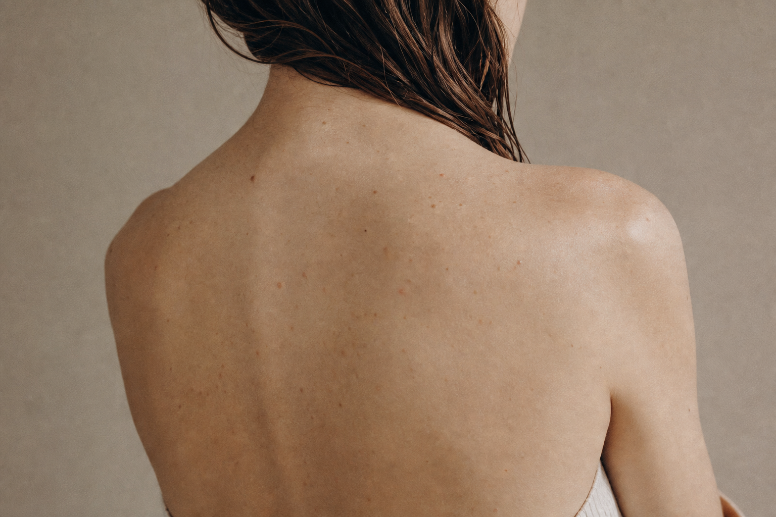Boutons dans le dos : pourquoi ils apparaissent et comment s'en débarrasser