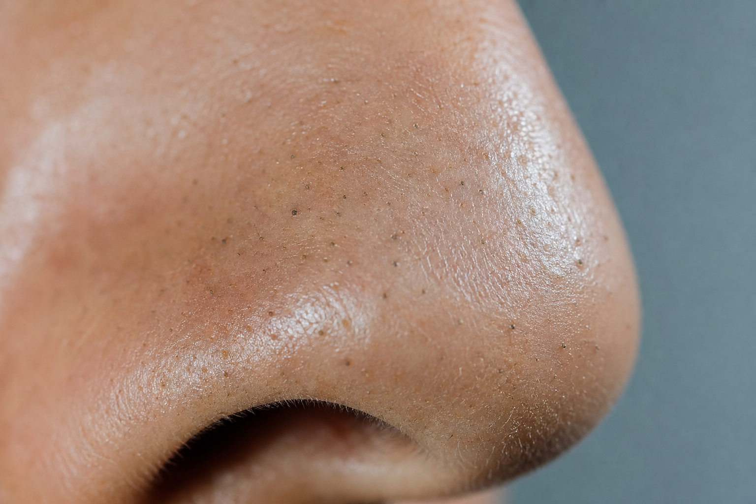 Comment enlever les points noirs ?