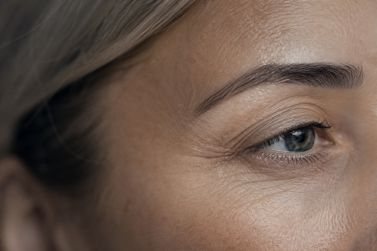 Rides du contour des yeux : pattes d'oie, ridules et solutions efficaces